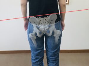 男性にも骨盤矯正は必要？
